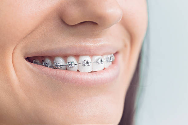 Full Mouth Reconstruction in Iowa Park, TX